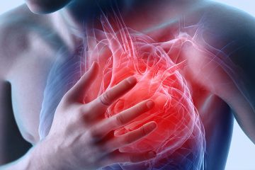 Pericarditis, Trauma, and Its Origins