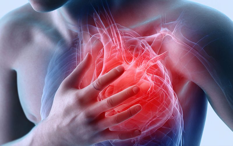 Pericarditis, Trauma, and Its Origins